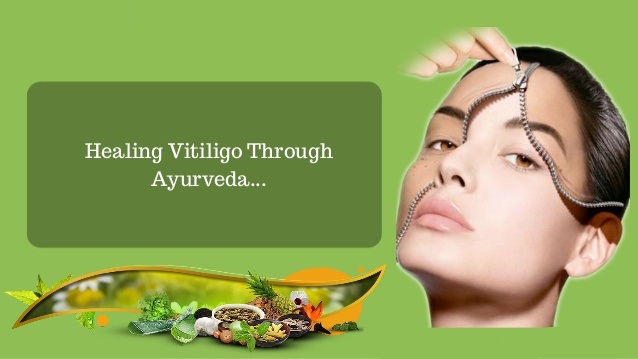 ayurvedic-vitiligo-treatment-in-india-ayurvedic-treatment-for-white-spots-in-india-1-638